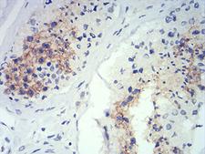 ATG14 Antibody - Immunohistochemical analysis of paraffin-embedded testis tissues using ATG14L mouse mAb with DAB staining.