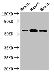 ATG14 Antibody - Western Blot Positive WB detected in: Rat brain tissue, Mouse heart tissue, Mouse brain tissue All lanes: ATG14 antibody at 2µg/ml Secondary Goat polyclonal to rabbit IgG at 1/50000 dilution Predicted band size: 56, 43 kDa Observed band size: 56 kDa
