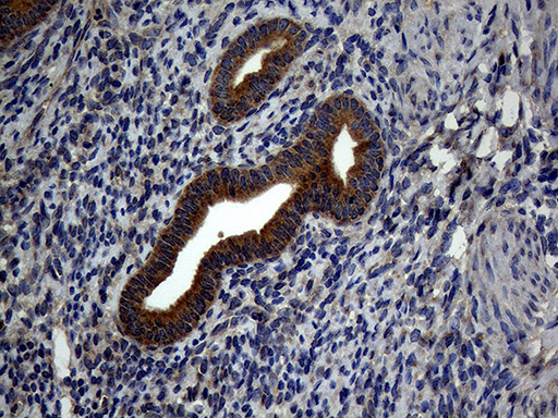 ATG16L1 / ATG16L Antibody - Immunohistochemical staining of paraffin-embedded Human endometrium tissue within the normal limits using anti-ATG16L1 mouse monoclonal antibody. (Heat-induced epitope retrieval by 1mM EDTA in 10mM Tris buffer. (pH8.5) at 120°C for 3 min. (1:2000)