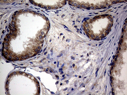 ATG16L1 / ATG16L Antibody - Immunohistochemical staining of paraffin-embedded Human prostate tissue within the normal limits using anti-ATG16L1 mouse monoclonal antibody. (Heat-induced epitope retrieval by 1mM EDTA in 10mM Tris buffer. (pH8.5) at 120°C for 3 min. (1:2000)