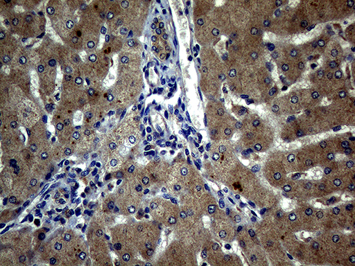ATG16L1 / ATG16L Antibody - Immunohistochemical staining of paraffin-embedded Human liver tissue within the normal limits using anti-ATG16L1 mouse monoclonal antibody. (Heat-induced epitope retrieval by 1mM EDTA in 10mM Tris buffer. (pH8.5) at 120°C for 3 min. (1:2000)
