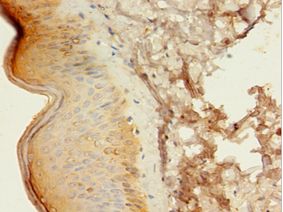 ATG16L1 / ATG16L Antibody - Immunohistochemistry of paraffin-embedded human skin tissue using antibody at 1:100 dilution.  This image was taken for the unconjugated form of this product. Other forms have not been tested.