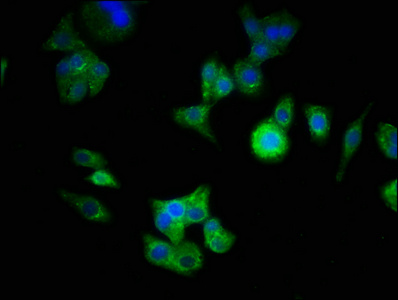 ATG16L1 / ATG16L Antibody - Immunofluorescence staining of HepG2 cells with ATG16L1 Antibody at 1:333, counter-stained with DAPI. The cells were fixed in 4% formaldehyde, permeabilized using 0.2% Triton X-100 and blocked in 10% normal Goat Serum. The cells were then incubated with the antibody overnight at 4°C. The secondary antibody was Alexa Fluor 488-congugated AffiniPure Goat Anti-Rabbit IgG(H+L).