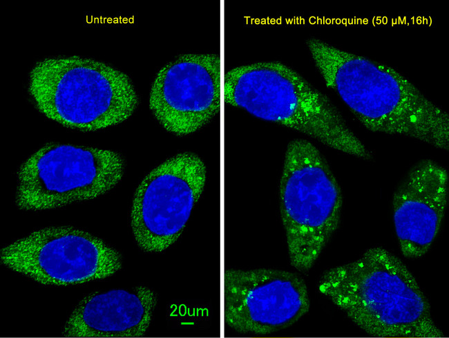 ATG16L1 / ATG16L Antibody - Immunofluorescence of U251 cells, using ATG16L Antibody. U251 cells(right) were treated with Chloroquine (50 mu M,16h). Antibody was diluted at 1:25 dilution. Alexa Fluor 488-conjugated goat anti-rabbit lgG at 1:400 dilution was used as the secondary antibody (green). DAPI was used to stain the cell nuclear (blue).