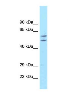 ATG16L1 / ATG16L Antibody - ATG16L1 antibody Western blot of Fetal Liver lysate. Antibody concentration 1 ug/ml. This image was taken for the unconjugated form of this product. Other forms have not been tested.