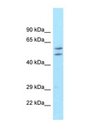 ATG16L1 / ATG16L Antibody - ATG16L1 antibody Western blot of Fetal Liver lysate. Antibody concentration 1 ug/ml. This image was taken for the unconjugated form of this product. Other forms have not been tested.