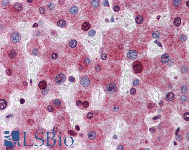 ATG16L1 / ATG16L Antibody - Anti-ATG16L1 antibody IHC of human liver. Immunohistochemistry of formalin-fixed, paraffin-embedded tissue after heat-induced antigen retrieval. Antibody concentration 5 ug/ml.  This image was taken for the unconjugated form of this product. Other forms have not been tested.