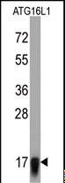 ATG16L1 / ATG16L Antibody - Western blot of anti-ATG16L1 Monoclonal Antibody by ATG16L1 recombinant protein (Fragment). ATG16L1 (Fragment) protein (arrow) was detected using the purified antibody. At 1:2000.