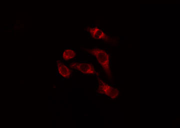 ATG16L1 / ATG16L Antibody - Staining HeLa cells by IF/ICC. The samples were fixed with PFA and permeabilized in 0.1% Triton X-100, then blocked in 10% serum for 45 min at 25°C. The primary antibody was diluted at 1:200 and incubated with the sample for 1 hour at 37°C. An Alexa Fluor 594 conjugated goat anti-rabbit IgG (H+L) antibody, diluted at 1/600, was used as secondary antibody.