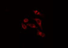 ATG16L1 / ATG16L Antibody - Staining HeLa cells by IF/ICC. The samples were fixed with PFA and permeabilized in 0.1% Triton X-100, then blocked in 10% serum for 45 min at 25°C. The primary antibody was diluted at 1:200 and incubated with the sample for 1 hour at 37°C. An Alexa Fluor 594 conjugated goat anti-rabbit IgG (H+L) antibody, diluted at 1/600, was used as secondary antibody.