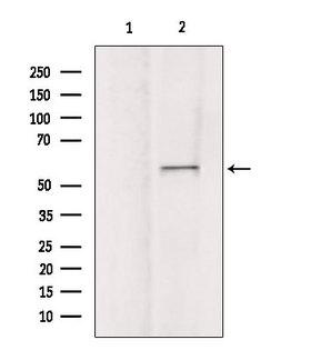 ATG16L1 / ATG16L Antibody - Western blot analysis of extracts of mouse brain tissue using ATG16L1 antibody. Lane 1 was treated with the blocking peptide.