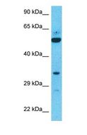 ATG16L2 Antibody - Western blot of ATG16L2 Antibody with human 786-0 Whole Cell lysate.  This image was taken for the unconjugated form of this product. Other forms have not been tested.