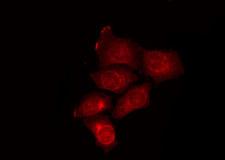 ATG16L2 Antibody - Staining HepG2 cells by IF/ICC. The samples were fixed with PFA and permeabilized in 0.1% Triton X-100, then blocked in 10% serum for 45 min at 25°C. The primary antibody was diluted at 1:200 and incubated with the sample for 1 hour at 37°C. An Alexa Fluor 594 conjugated goat anti-rabbit IgG (H+L) Ab, diluted at 1/600, was used as the secondary antibody.
