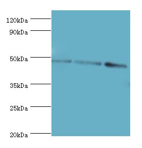 ATG18 / WIPI1 Antibody - Western blot. All lanes: WIPI1 antibody at 6 ug/ml. Lane 1: 293T whole cell lysate. Lane 2: NIH3T3 whole cell lysate. Lane 3: mouse skeletal muscle. Secondary antibody: Goat polyclonal to rabbit at 1:10000 dilution. Predicted band size: 49 kDa. Observed band size: 49 kDa Immunohistochemistry.
