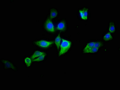 ATG2B Antibody - Immunofluorescence staining of HepG2 cells with ATG2B Antibody at 1:133, counter-stained with DAPI. The cells were fixed in 4% formaldehyde, permeabilized using 0.2% Triton X-100 and blocked in 10% normal Goat Serum. The cells were then incubated with the antibody overnight at 4°C. The secondary antibody was Alexa Fluor 488-congugated AffiniPure Goat Anti-Rabbit IgG(H+L).