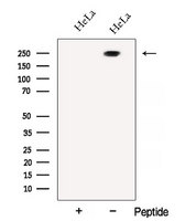 ATG2B Antibody - Western blot analysis of extracts of HeLa cells using ATG2B antibody. The lane on the left was treated with blocking peptide.