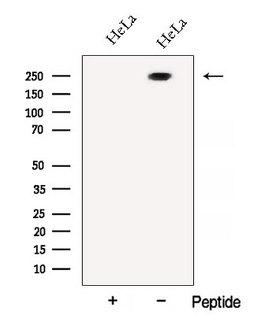 ATG2B Antibody - Western blot analysis of extracts of HeLa cells using ATG2B antibody. The lane on the left was treated with blocking peptide.
