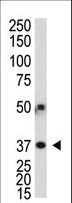 ATG3 Antibody - Polyclonal antibody was used in Western blot to detect human APG3L in transfected 293 cells.