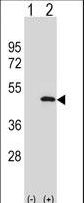 ATG3 Antibody - Western blot of APG3L (arrow) using rabbit polyclonal APG3L Antibody (I98). 293 cell lysates (2 ug/lane) either nontransfected (Lane 1) or transiently transfected (Lane 2) with the APG3L gene.