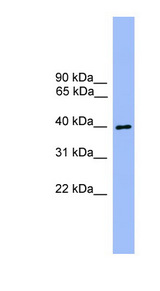 ATG3 Antibody - ATG3 antibody Western blot of HeLa lysate. This image was taken for the unconjugated form of this product. Other forms have not been tested.