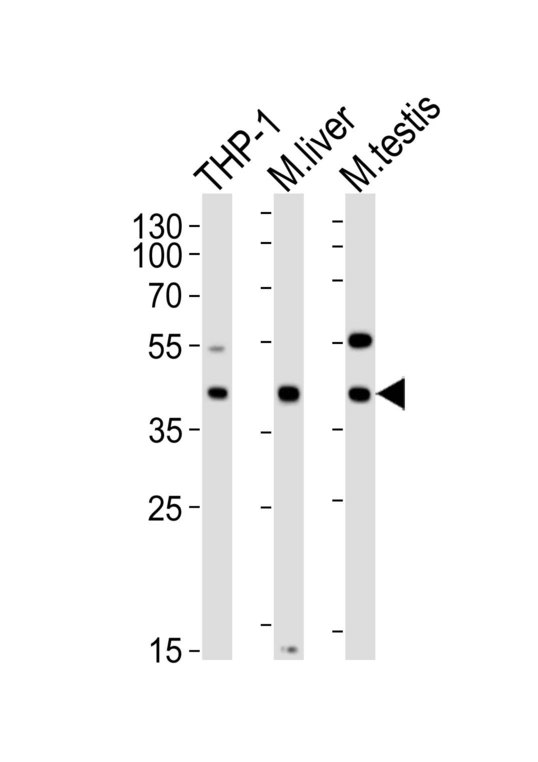 ATG3 Antibody - Western blot of lysates from THP-1 cell line, mouse liver, mouse testis tissue (from left to right) with ATG3 Antibody. Antibody was diluted at 1:1000 at each lane. A goat anti-rabbit IgG H&L (HRP) at 1:10000 dilution was used as the secondary antibody. Lysates at 20 ug per lane.