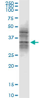 ATG3 Antibody - ATG3 monoclonal antibody (M04), clone 1G3. Western blot of ATG3 expression in HepG2.