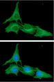 ATG3 Antibody - ICC/IF analysis of ATG3 in HeLa cells. The cell was stained with ATG3 antibody (1:100).The secondary antibody (green) was used Alexa Fluor 488. DAPI was stained the cell nucleus (blue).