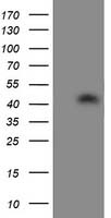 ATG3 Antibody - HEK293T cells were transfected with the pCMV6-ENTRY control. (Left lane) or pCMV6-ENTRY ATG3. (Right lane) cDNA for 48 hrs and lysed