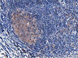 ATG3 Antibody - Immunohistochemical staining of paraffin-embedded Human lymph node tissue within the normal limits using anti-ATG3 mouse monoclonal antibody. (Heat-induced epitope retrieval by 10mM citric buffer, pH6.0, 100C for 10min,
