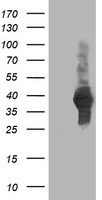 ATG3 Antibody - HEK293T cells were transfected with the pCMV6-ENTRY control (Left lane) or pCMV6-ENTRY ATG3 (Right lane) cDNA for 48 hrs and lysed. Equivalent amounts of cell lysates (5 ug per lane) were separated by SDS-PAGE and immunoblotted with anti-ATG3.