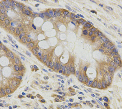 ATG3 Antibody - Immunohistochemistry of paraffin-embedded human stomach tissue.