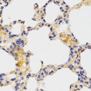 ATG3 Antibody - Immunohistochemistry of paraffin-embedded mouse lung tissue.
