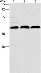 ATG3 Antibody - Western blot analysis of K562 cell, mouse kidney tissue and Raji cell, using ATG3 Polyclonal Antibody at dilution of 1:325.