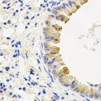 ATG3 Antibody - Immunohistochemical analysis of ATG3 staining in mouse lung formalin fixed paraffin embedded tissue section. The section was pre-treated using heat mediated antigen retrieval with sodium citrate buffer (pH 6.0). The section was then incubated with the antibody at room temperature and detected using an HRP conjugated compact polymer system. DAB was used as the chromogen. The section was then counterstained with hematoxylin and mounted with DPX.