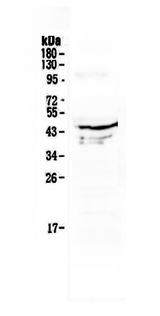 ATG3 Antibody - Western blot analysis of Apg3 using anti-Apg3 antibody. Electrophoresis was performed on a 5-20% SDS-PAGE gel at 70V (Stacking gel) / 90V (Resolving gel) for 2-3 hours. The sample well of each lane was loaded with 50ug of sample under reducing conditions. Lane 1: human placenta tissue lysate. After Electrophoresis, proteins were transferred to a Nitrocellulose membrane at 150mA for 50-90 minutes. Blocked the membrane with 5% Non-fat Milk/ TBS for 1.5 hour at RT. The membrane was incubated with rabbit anti-Apg3 antigen affinity purified polyclonal antibody at 0.5 µg/mL overnight at 4°C, then washed with TBS-0.1% Tween 3 times with 5 minutes each and probed with a goat anti-rabbit IgG-HRP secondary antibody at a dilution of 1:10000 for 1.5 hour at RT. The signal is developed using an Enhanced Chemiluminescent detection (ECL) kit with Tanon 5200 system. A specific band was detected for Apg3 at approximately 45KD. The expected band size for Apg3 is at 36KD.