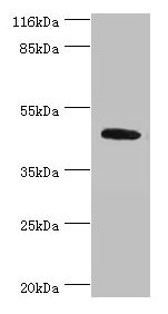 ATG4A Antibody - Western blot All lanes: ATG4A antibody at 2µg/ml + Mouse brain tissue Secondary Goat polyclonal to rabbit IgG at 1/10000 dilution Predicted band size: 46, 39, 37, 43 kDa Observed band size: 46 kDa