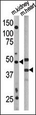 ATG4A Antibody - The anti-APG4A antibody is used in Western blot to detect APG4A in mouse kidney (left) and mouse heart (right) tissue lysates
