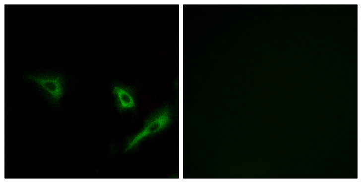 ATG4A Antibody - Immunofluorescence analysis of A549 cells, using ATG4A Antibody. The picture on the right is blocked with the synthesized peptide.