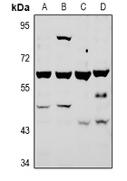 ATG4A Antibody - Western blot analysis of ATG4A expression in HCT116 (A), HepG2 (B), CT26 (C), PC12 (D) whole cell lysates.