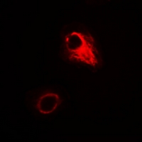 ATG4A Antibody - Immunofluorescent analysis of ATG4A staining in A549 cells. Formalin-fixed cells were permeabilized with 0.1% Triton X-100 in TBS for 5-10 minutes and blocked with 3% BSA-PBS for 30 minutes at room temperature. Cells were probed with the primary antibody in 3% BSA-PBS and incubated overnight at 4 °C in a hidified chamber. Cells were washed with PBST and incubated with Alexa Fluor 647-conjugated secondary antibody (red) in PBS at room temperature in the dark.