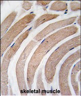 ATG4D Antibody - Formalin-fixed and paraffin-embedded human skeletal muscle tissue reacted with APG4D Antibody (S341) , which was peroxidase-conjugated to the secondary antibody, followed by DAB staining. This data demonstrates the use of this antibody for immunohistochemistry; clinical relevance has not been evaluated.
