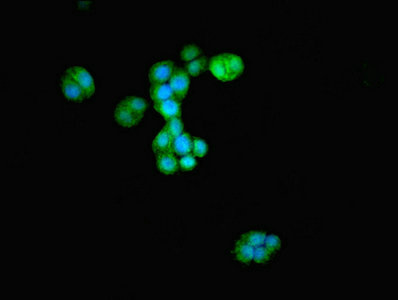 ATG4D Antibody - Immunofluorescent analysis of PC-3 cells using ATG4D Antibody at dilution of 1:100 and Alexa Fluor 488-congugated AffiniPure Goat Anti-Rabbit IgG(H+L)