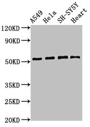 ATG4D Antibody - Western Blot Positive WB detected in: A549 whole cell lysate, Hela whole cell lysate, SH-SY5Y whole cell lysate, Mouse heart tissue All lanes: ATG4D antibody at 2.8µg/ml Secondary Goat polyclonal to rabbit IgG at 1/50000 dilution Predicted band size: 53, 17 kDa Observed band size: 53 kDa