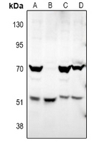 ATG4D Antibody - Western blot analysis of ATG4D expression in Hela (A), A549 (B), PC12 (C), CT26 (D) whole cell lysates.