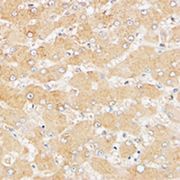 ATG4D Antibody - Immunohistochemical analysis of ATG4D staining in human liver formalin fixed paraffin embedded tissue section. The section was pre-treated using heat mediated antigen retrieval with sodium citrate buffer (pH 6.0). The section was then incubated with the antibody at room temperature and detected using an HRP conjugated compact polymer system. DAB was used as the chromogen. The section was then counterstained with haematoxylin and mounted with DPX.