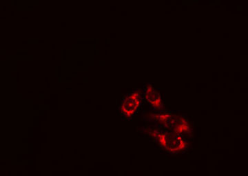 ATG4D Antibody - Staining HeLa cells by IF/ICC. The samples were fixed with PFA and permeabilized in 0.1% Triton X-100, then blocked in 10% serum for 45 min at 25°C. The primary antibody was diluted at 1:200 and incubated with the sample for 1 hour at 37°C. An Alexa Fluor 594 conjugated goat anti-rabbit IgG (H+L) antibody, diluted at 1/600, was used as secondary antibody.