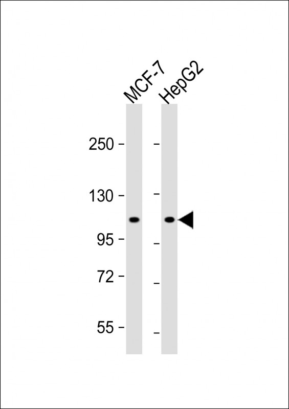 ATG9A Antibody - All lanes: Anti-APG9L1 Antibody (S738) at 1:1000 dilution Lane 1: MCF-7 whole cell lysate Lane 2: HepG2 whole cell lysate Lysates/proteins at 20 µg per lane. Secondary Goat Anti-Rabbit IgG, (H+L), Peroxidase conjugated at 1/10000 dilution. Predicted band size: 94kDa Blocking/Dilution buffer: 5% NFDM/TBST.