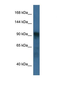 ATG9A Antibody - ATG9A antibody Western blot of Mouse Pancreas lysate. Antibody concentration 1 ug/ml.  This image was taken for the unconjugated form of this product. Other forms have not been tested.
