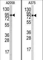 ATG9A Antibody - Western blot of anti-Autophagy APG9L1 Antibody in A2058 and A375 cell line lysates (35 ug/lane). APG9L1(arrow) was detected using the purified antibody.