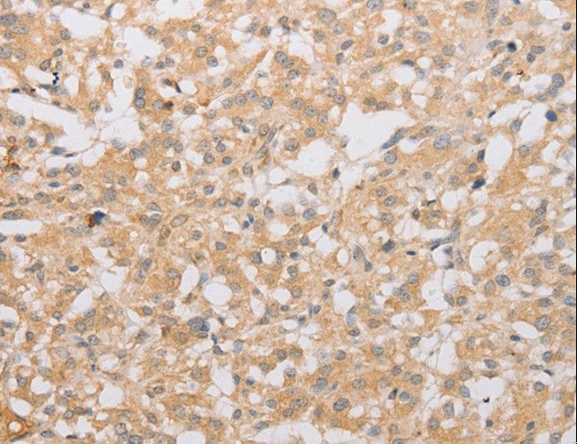 ATG9A Antibody - Immunohistochemistry of paraffin-embedded Human brain using ATG9A Polyclonal Antibody at dilution of 1:40.